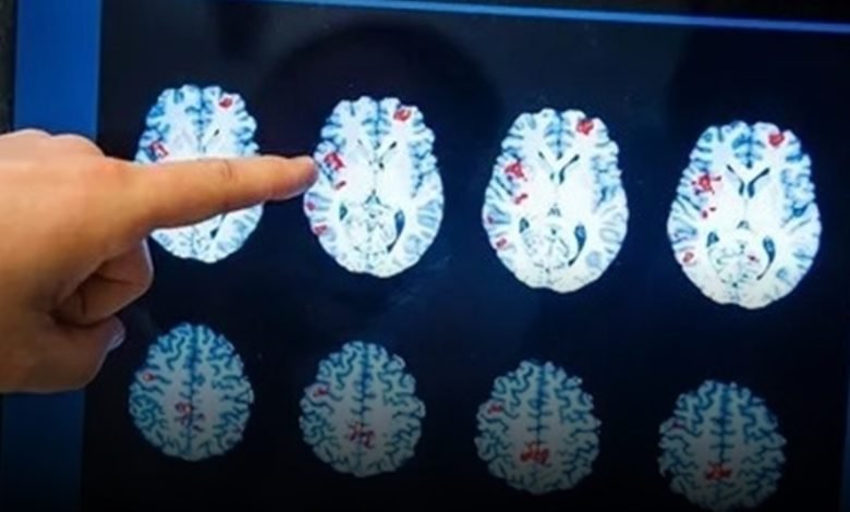 دراسة: الأزمات العصبية في بداية العمر تنتقل عبر ثلاثة أجيال- OIMEDIA News - بوابة الذكاء الاصطناعي