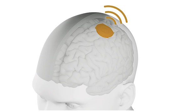 Neuralink: ثاني مريض في تجارب إيلون ماسك يستخدم برامج التصميم والألعاب- OIMEDIA News - بوابة الذكاء الاصطناعي